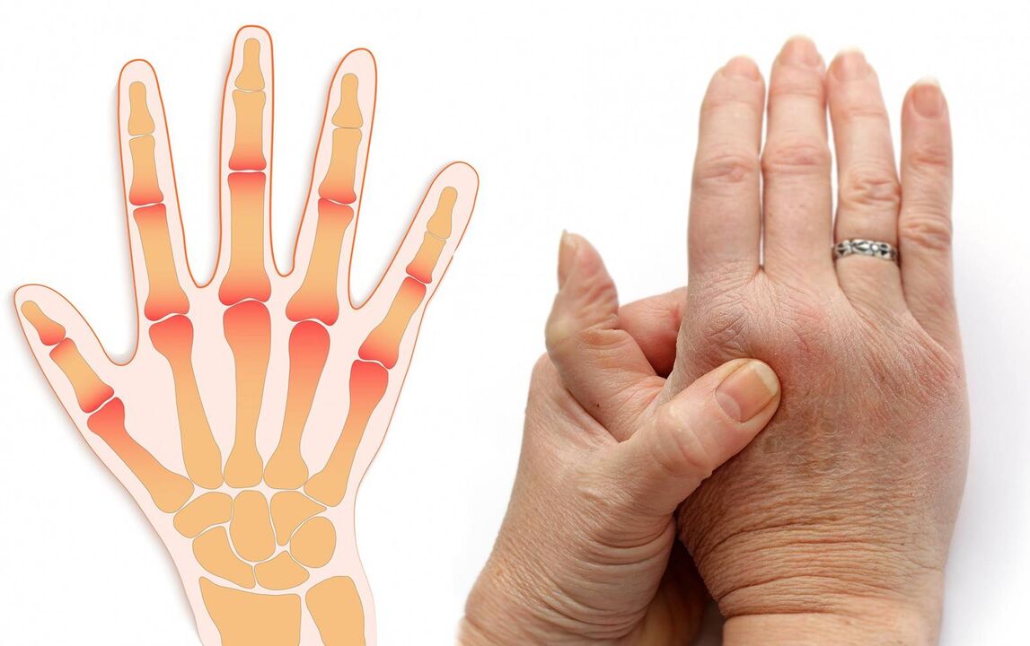 bolezni prstov