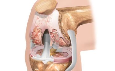 Shema ligamentov
