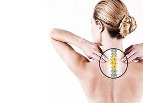 osteohondroza torakalne hrbtenice