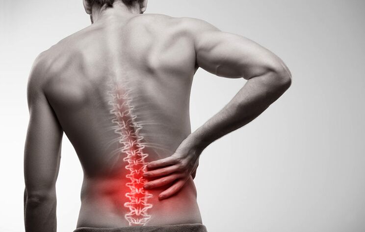 bolečine v spodnjem delu hrbta zaradi osteohondroze